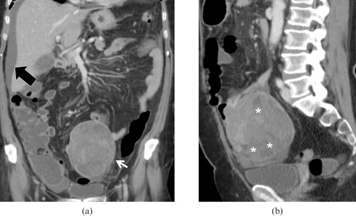 Figure 16