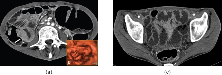 Figure 11