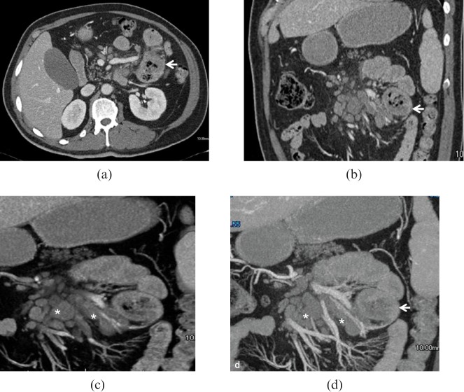 Figure 14