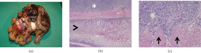 Figure 18