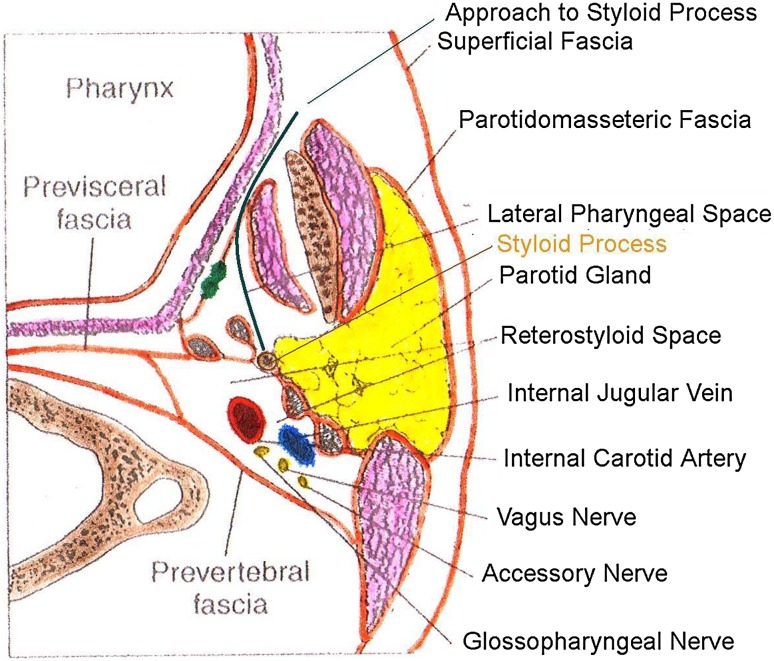 Fig. 3