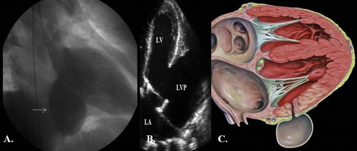 Fig. 1