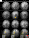 Fig 3