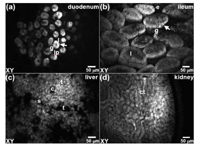 Fig. 12