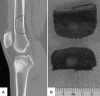 Fig. 3A–B