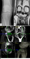 Fig. 1A–F