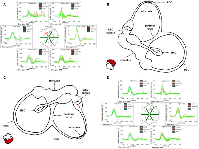 Figure 13