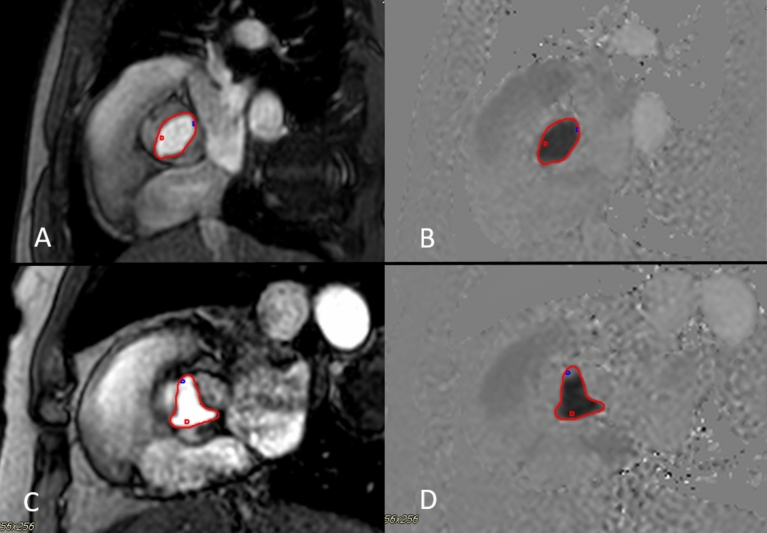 Fig. 3