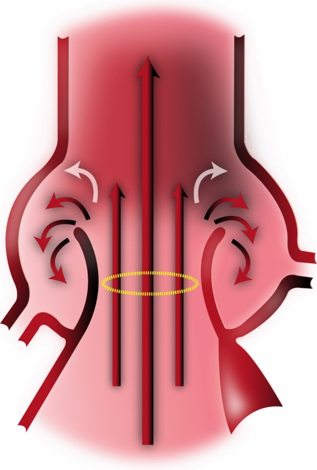 Fig. 1