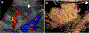 Fig. 12