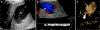 Fig. 10