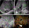 Fig. 11