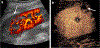 Fig. 15