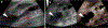 Fig. 16
