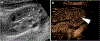 Fig. 13