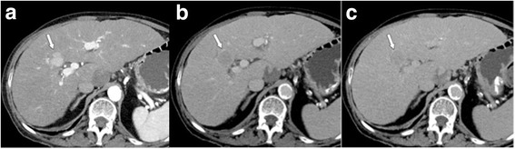 Fig. 10