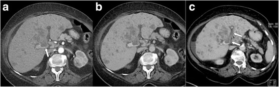 Fig. 12