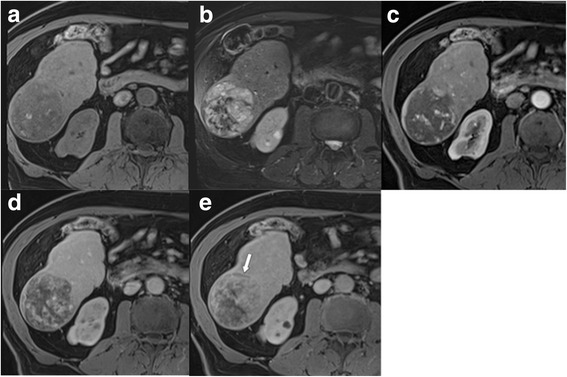 Fig. 11