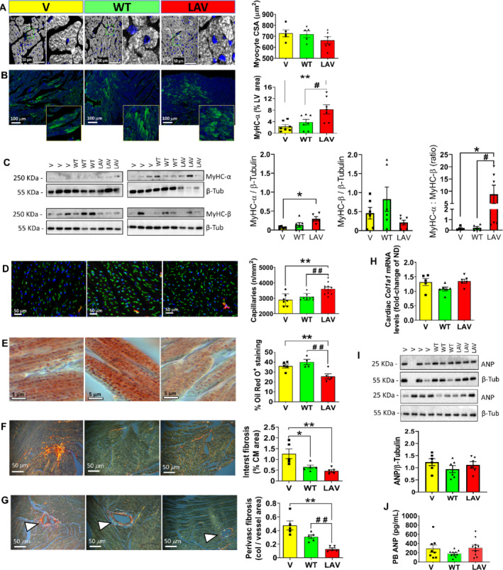 EJHF-1840-FIG-0003-c