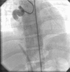 Fig. 4