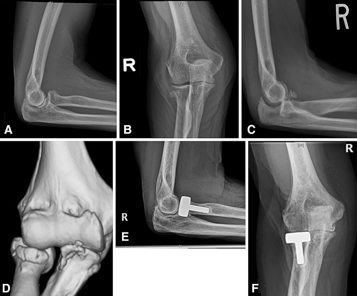 Fig. 3A–F