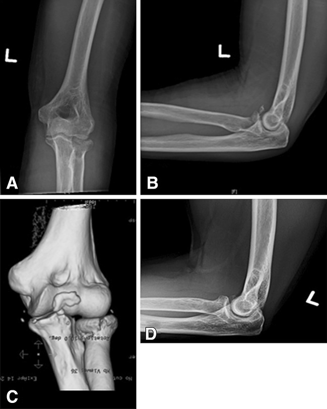 Fig. 2A–D