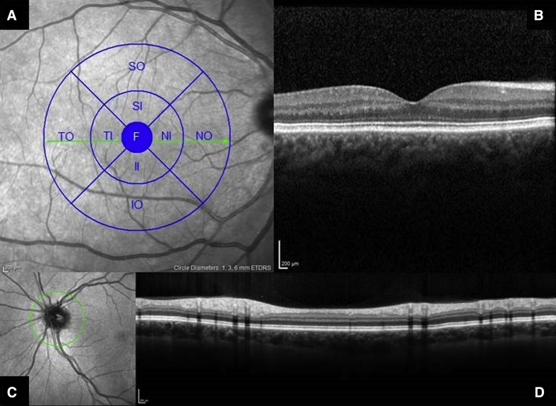 Fig. 1