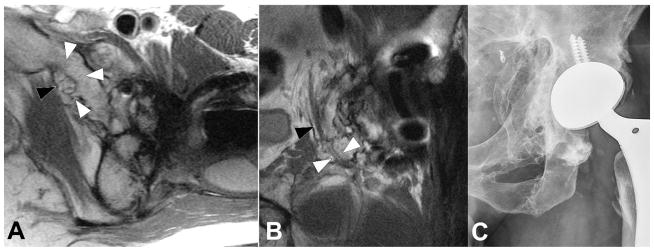 Figure 15