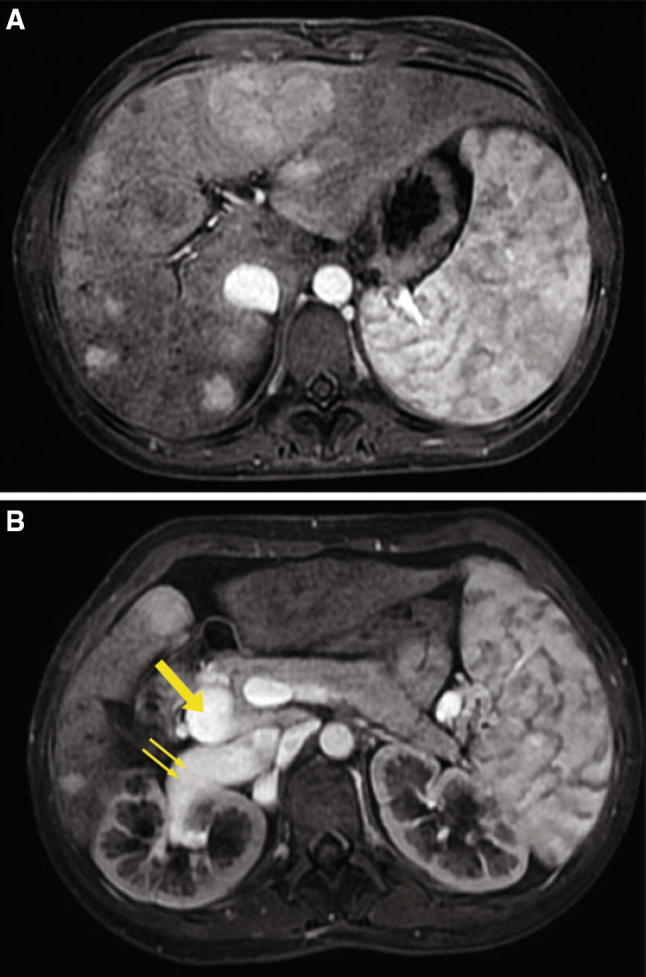 Fig. 2