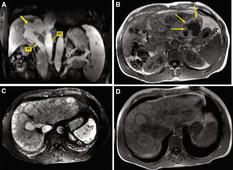 Fig. 4