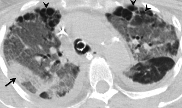 Fig. 14