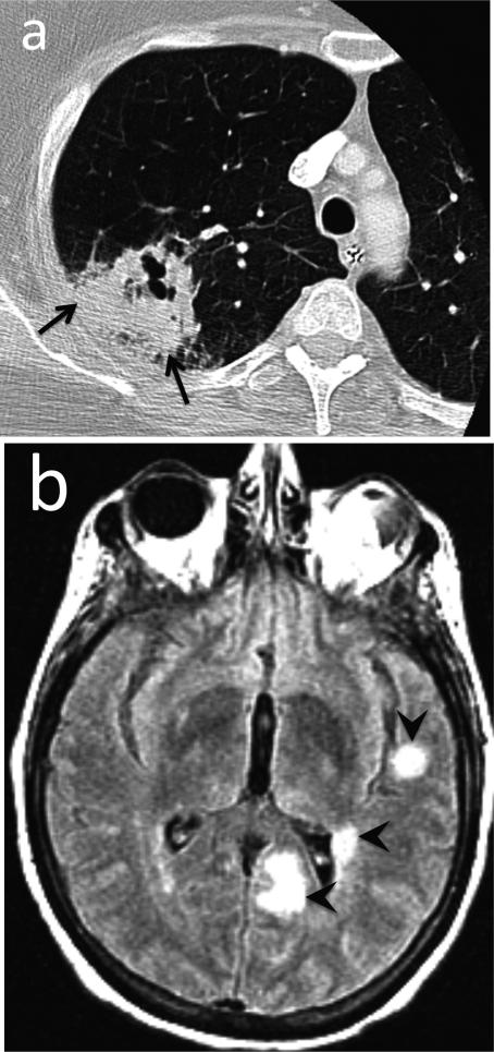 Fig. 15