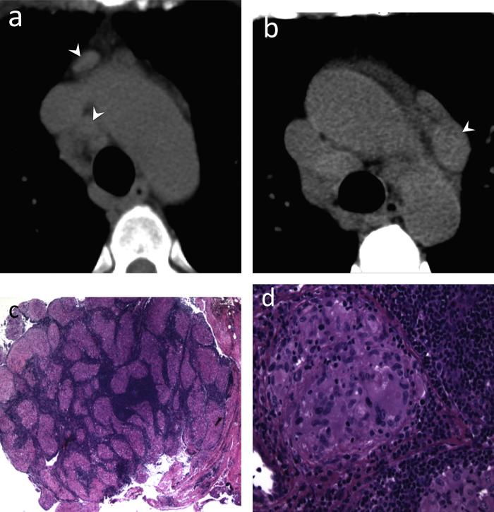 Fig. 13