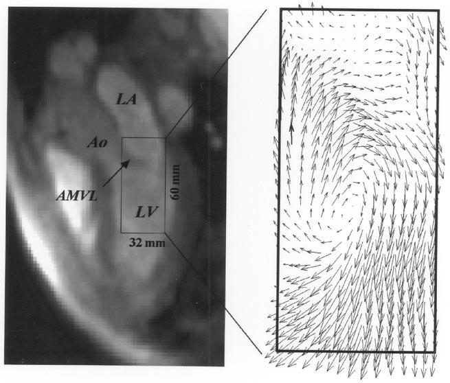 Fig. 14