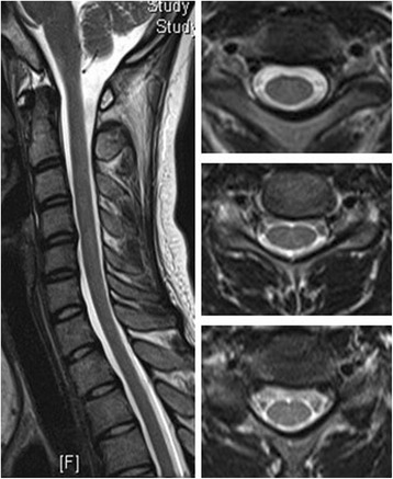 Fig. 3