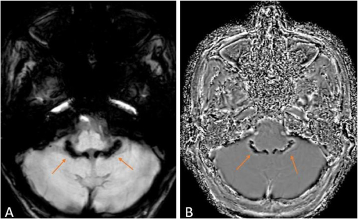 Fig 2: