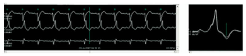 Fig. 7