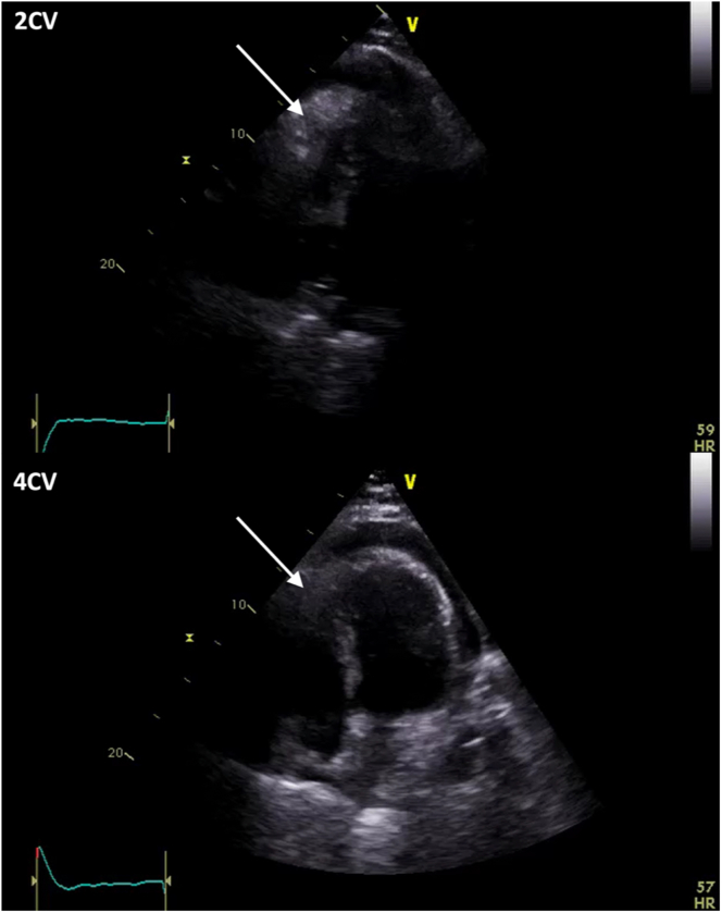 Figure 5