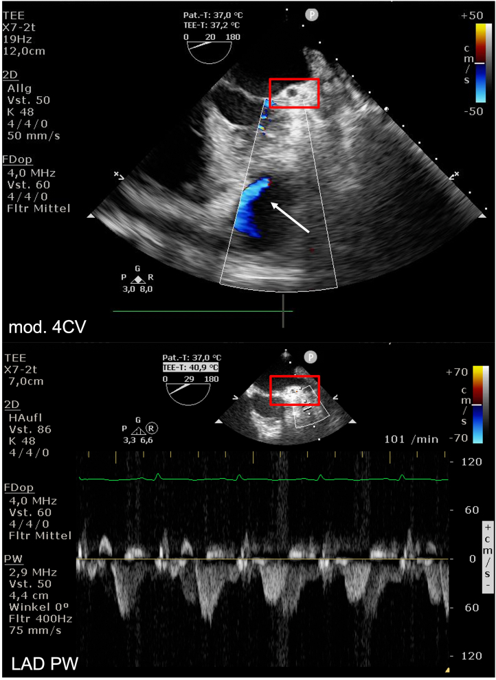 Figure 6