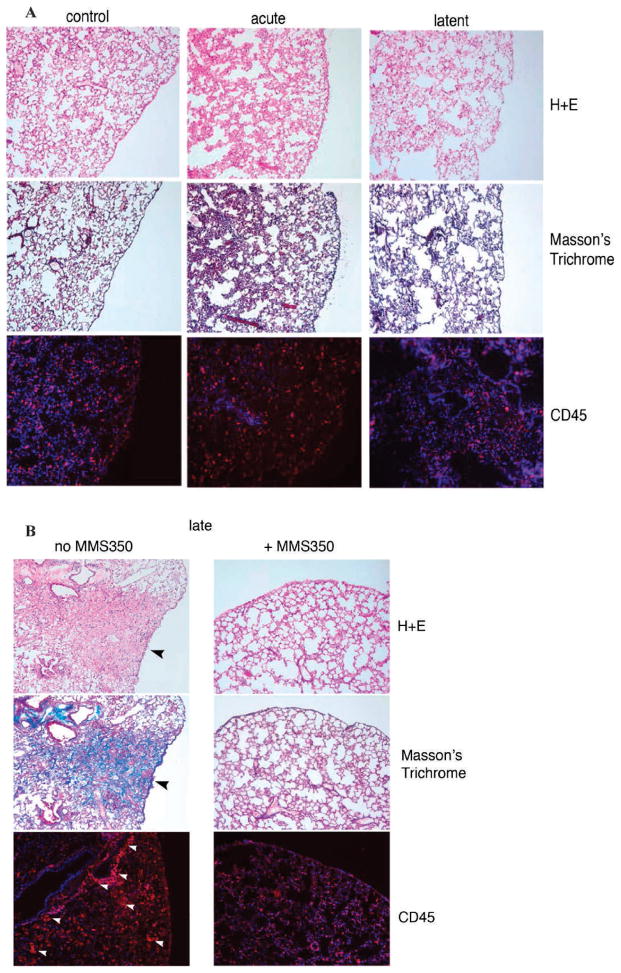 FIG. 12