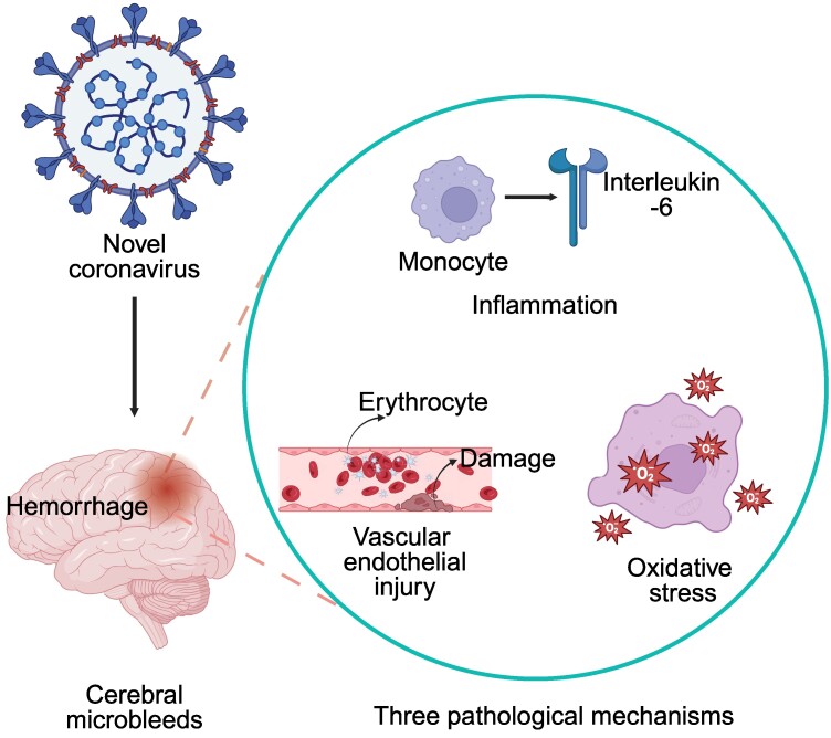 Cerebral microbleeds in patients with covid 19 is there an inevitable