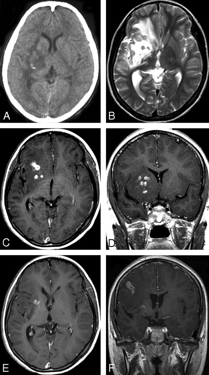 Fig 3.