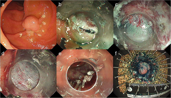 Fig. 1
