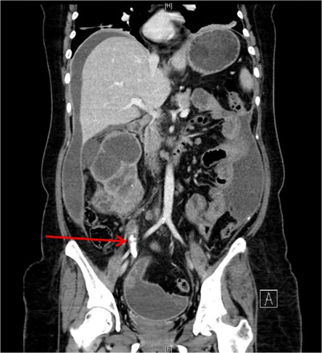 Figure 2: