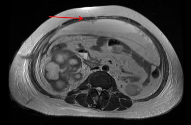 Figure 4: