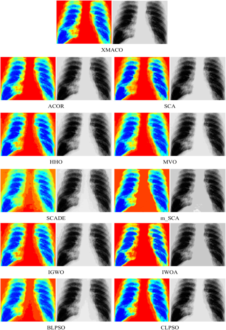 Fig. 14