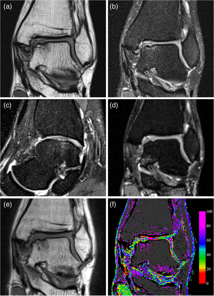 FIGURE 1