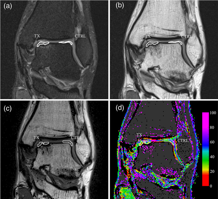 FIGURE 2