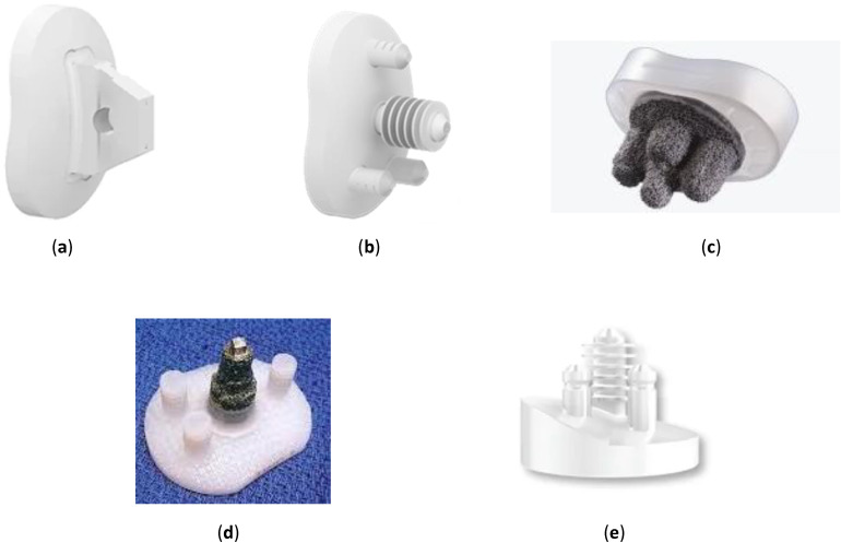 Glenoid Prosthesis Design Considerations in Anatomic Total Shoulder ...