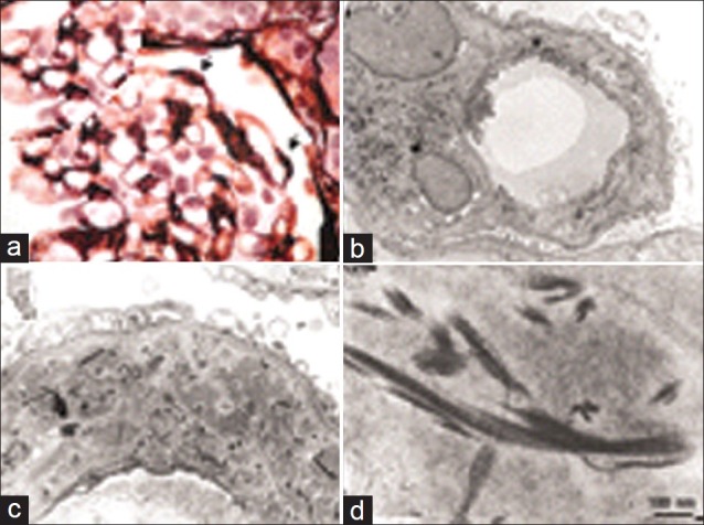 Figure 25